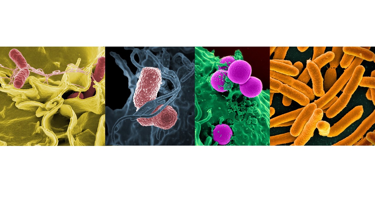 Picture including four square shaped colorized micrographs of different bacteria species